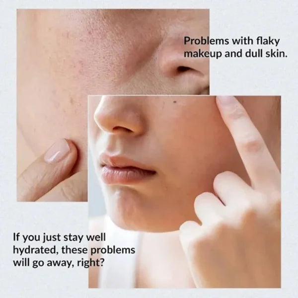 Anua Birch 70% Moisture Boosting Serum Korea -