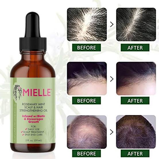 Mielle Rosemary Mint Scalp & Hair Strengthening Oil 59 - Ml -